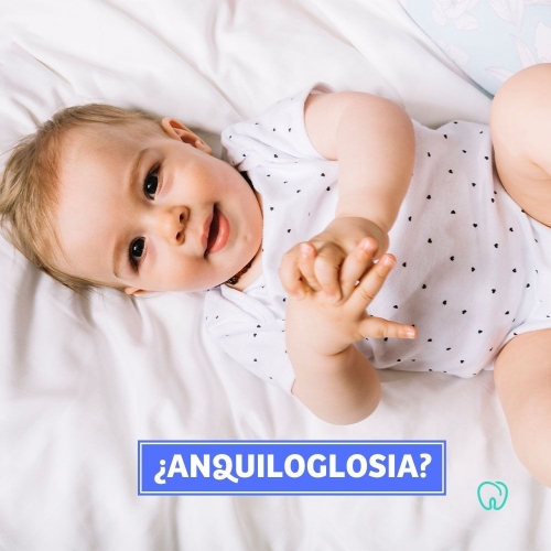 ANQUILOGLOSIA